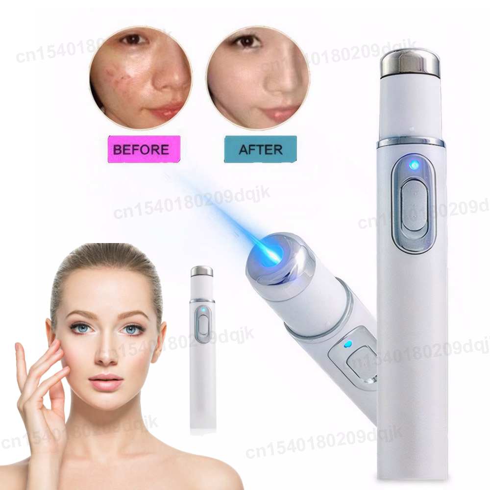 Acne Light Therapy Pen - Blauwlichttherapie Acne Pen LED Gezichtslichttherapie voor